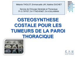 Ostéosynthèse pour tumeur thoracique