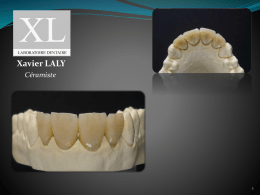 Présentation Laboratoire Dentaire Xavier LALY [Août 2007]