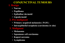 CONJUNCTIVAL TUMOURS 1. Benign • • • •  Naevus Papilloma Epibulbar dermoid Lipodermoid  2. Pre-malignant • Primary acquired melanosis ( PAM ) • Intraepithelial neoplasia (carcinoma in situ)  3.