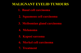 MALIGNANT EYELID TUMOURS 1. Basal cell carcinoma 2. Squamous cell carcinoma 3. Meibomian gland carcinoma 4.