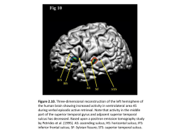 Figure 2.10. Three-dimensional reconstruction of the left hemisphere of the human brain showing increased activity in ventrolateral area 45 during verbal episodic.