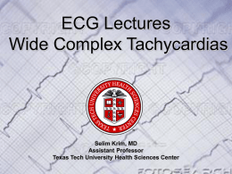 ECG Lectures Wide Complex Tachycardias  Selim Krim, MD Assistant Professor Texas Tech University Health Sciences Center.