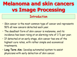 Melanoma and skin cancers vs Image Processing Skin cancer and melanoma   Skin cancer : most common of all cancers.