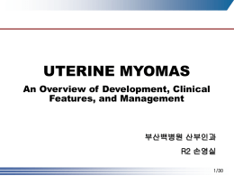 UTERINE MYOMAS An Overview of Development, Clinical Features, and Management  부산백병원 산부인과 R2 손영실 1/30