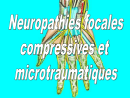 Neuropathies canalaires et micro-traumatiques Atteintes monotronculaires liées à une compression (étirement), le plus souvent chronique, d’un tronc nerveux périphérique en un endroit où il.