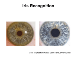 Iris Recognition  Slides adapted from Natalia Schmid and John Daugman Outline • Anatomy • Iris Recognition System • Image Processing (John Daugman) - iris localization -