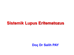 Sistemik Lupus Eritematozus  Doç Dr Salih PAY SLE   Otoimmün    Remisyon ve alevlenmeler    K/E= 9/1