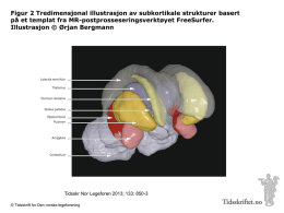 Figur 2 Tredimensjonal illustrasjon av subkortikale strukturer basert på et templat fra MR-postprosseseringsverktøyet FreeSurfer. Illustrasjon © Ørjan Bergmann  Tidsskr Nor Legeforen 2013; 133: