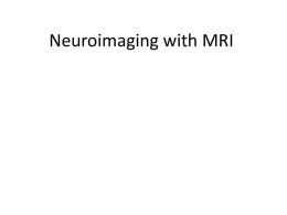 Neuroimaging with MRI -2- Topics • Quick overview of MRI physics (all on one slide!) • Some images and their applications – – – –  T1-weighted =