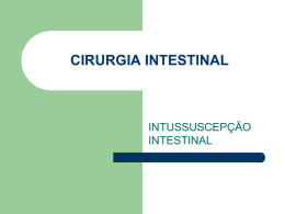 CIRURGIA INTESTINAL  INTUSSUSCEPÇÃO INTESTINAL CONCEITO Invaginação de um segmento intestinal (intussuscepto) para dentro do lúmen de um segmento ajacente-cotíguo (intussuscipiente). 