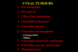 UVEAL TUMOURS 1. Iris melanoma 2. Iris naevus  3. Ciliary boy melanoma 4. Choroidal melanoma  5.