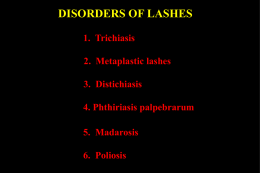 DISORDERS OF LASHES 1. Trichiasis 2. Metaplastic lashes 3. Distichiasis 4. Phthiriasis palpebrarum 5. Madarosis 6.