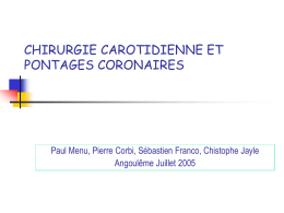 CHIRURGIE CAROTIDIENNE ET PONTAGES CORONAIRES  Paul Menu, Pierre Corbi, Sébastien Franco, Chistophe Jayle Angoulême Juillet 2005