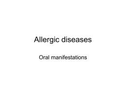 Allergic diseases Oral manifestations Hypersensitivity reactions • The immune system is an integral part of human protection against disease, but the normally protective immune.