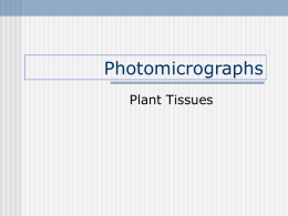 Photomicrographs Plant Tissues BOTANY      Algae Cladophora species Filament in form Several cells BOTANY     Algae Acetabularia species Many cells BOTANY     Algae Oedogonium species.