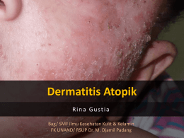 Dermatitis Atopik Rina Gustia Bag/ SMF Ilmu Kesehatan Kulit & Kelamin FK UNAND/ RSUP Dr.