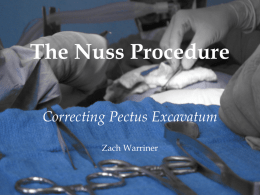The Nuss Procedure Correcting Pectus Excavatum Zach Warriner     The most common congenital chest wall abnormality Posterior depression of the inferior portion of the sternum with.