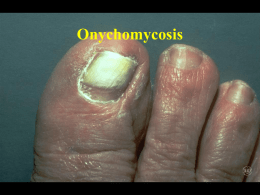 Onychomycosis Gouty Tophi Pyogenic Granuloma Knuckle Pads Bowen’s Disease Dermal Melanosis.