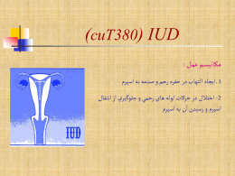   (cuT380) IUD    مكانيسم عمل  :      1 ـ ايجاد التهاب در حفره رحم و صدمه به اسپرم     -2 اختالل در حركات لوله هاي رحمي.