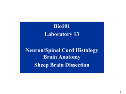 Bio101 Laboratory 13 Neuron/Spinal Cord Histology Brain Anatomy Sheep Brain Dissection Brain, Cranial Nerves, and Spinal Cord • Objectives for today’s lab – Become familiar with.