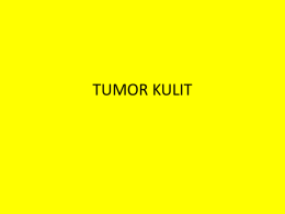TUMOR KULIT TUMOR KULIT Klasifikasi : I. Tumor Jinak berdiferensiasi normal (matang), pertumbuhan lambat, kdg2 berkapsul. Mis : keratosis seboroik II.