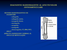DIAGNOSTIC RADIOIMAGISTIC AL AFECTIUNILOR OSTEOARTICULARE METODE RADIOIMAGISTICE DE EXAMINARE - radiografia, - radiografia mărită, - tomografie liniară, - arteriografia, - artrografia, - scintigrafia, - ultrasonografia, CT, IRM, PET, SPECT ASPECTUL RADIOLOGIC NORMAL.