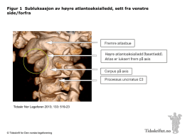 Figur 1 Subluksasjon av h&oslash;yre atlantoaksialledd, sett fra venstre side/forfra  Tidsskr Nor Legeforen 2013; 133: 519-23  &copy; Tidsskrift for Den norske legeforening.