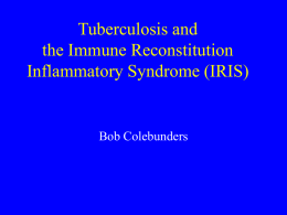 Tuberculosis and the Immune Reconstitution Inflammatory Syndrome (IRIS)  Bob Colebunders Names • Immune reconstitution inflammatory syndrome (IRIS) • Immune restoration disease (IRD) • Paradoxical reactions.