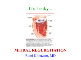 It’s Leaky...  MITRAL REGURGITATION Rami Khouzam, MD Mitral Regurgitation • Anatomy: 3 basic mechanisms of MR: 1- Alteration of Mitral leaflets, commissures, or annulus 2- Defective tensor.