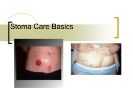 Stoma Care Basics Two basic types of diversions    Urinary Fecal Urinary Diversions.