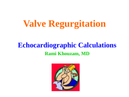 Valve Regurgitation Echocardiographic Calculations Rami Khouzam, MD Definitions/Equations: • Continuity equation: Flow (SV) = LVEDV - LVESV = A x TVI (SV:Stroke Volume, A: Area, TVI:Time.