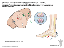 Illustrasjon 2 Somatosensorisk fremkalt respons brukes for å overvåke bakstrengsystemet (lemniscus medialis) i ryggmargen.