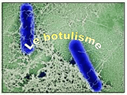 Introduction Quels sont les modes de contamination de la toxine botulinique? Mode d'action de la toxine botulinique Quels sont les symptômes du botulisme? Diagnostic de.