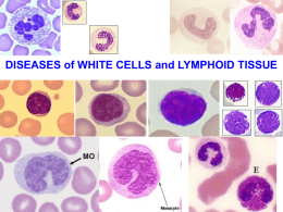 DISEASES of WHITE CELLS and LYMPHOID TISSUE • • • • • • • • • • • • • •  Topics for Chapter 14 Leukopenia/Neutropenia Leukocytosis Lymphadenitis/Lymphadenopathy (Malignant) Lymphoma NON-Hodgkins Lymphoma Hodgkins Lymphoma (Hodgkins Disease) ALL/CLL (Acute/Chronic Lymphocytic Leukemia) Multiple Myeloma M1/M2/M3/M4/M5/M6/M7 Myeloproliferative.
