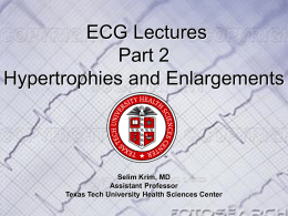 ECG Lectures Part 2 Hypertrophies and Enlargements  Selim Krim, MD Assistant Professor Texas Tech University Health Sciences Center.