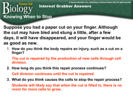 Interest Grabber Answers  Knowing When to Stop Suppose you had a paper cut on your finger.