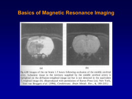 Basics of Magnetic Resonance Imaging Angular Momentum Orbital Angular Momentum    L  mr  v  Principles of Medical Imaging – Shung, Smith.