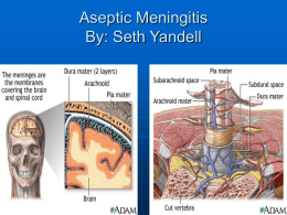 Aseptic Meningitis By: Seth Yandell Case Presentation   HPI: 31 y/o WF who 3 days prior to presentation had finished a 5 day course of.