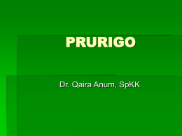 PRURIGO Dr. Qaira Anum, SpKK PRURIGO Kronis & rekuren Erupsi papular Klasifikasi Menurut KOCSARD : I.