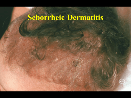 Seborrheic Dermatitis Atopic Dermatitis Herpes Simplex Ecthyma Alopecia Areata Acanthosis Nigricans.