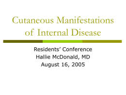 Cutaneous Manifestations of Internal Disease Residents’ Conference Hallie McDonald, MD August 16, 2005 Diabetes Mellitus According to Perez et al (3) ,approximately 30% of patients with.