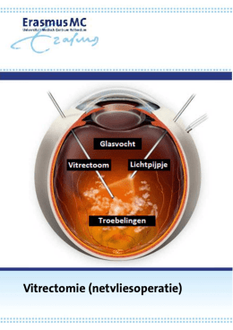 0000118-02_14 Vitrectomie (glasvocht operatie