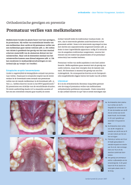 klik hier - Reinier Hoogeveen Orthodontie