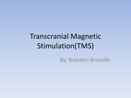 Transcranial Magnetic Stimulation(TMS) By: Brandon Brunelle
