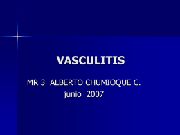 VASCULITIS MR 3  ALBERTO CHUMIOQUE C. junio  2007