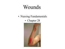 Wounds • Nursing Fundamentals • Chapter 28