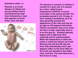 Exanthem subitu  or The disease is common in children 6
