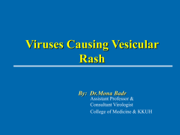 Viruses Causing Vesicular Rash By:  Dr.Mona Badr Assistant Professor &amp;