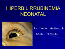 HIPERBILIRRUBINEMIA NEONATAL Lic. Frecia UCIN - H.N.S.E.