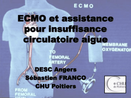 ECMO et assistance pour insuffisance circulatoire aigue DESC Angers